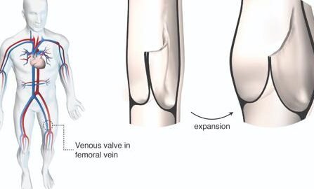 bioingenieria-de-valvulas-cardiacas-que-crecen-con-el-nino