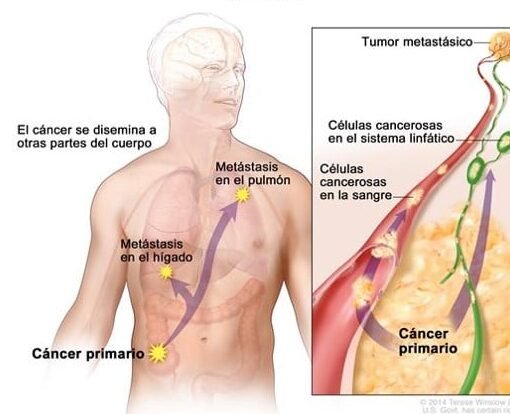 como-la-bioingenieria-ayuda-a-entender-la-metastasis