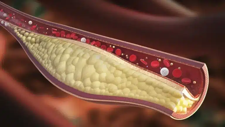 como-los-nanorobots-podrian-limpiar-las-arterias-desde-dentro