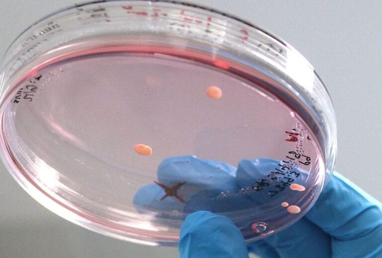 creacion-de-mini-cerebros-en-laboratorio-para-estudiar-el-autismo