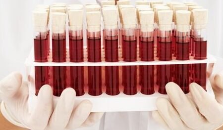 el-desarrollo-de-sangre-sintetica-universal