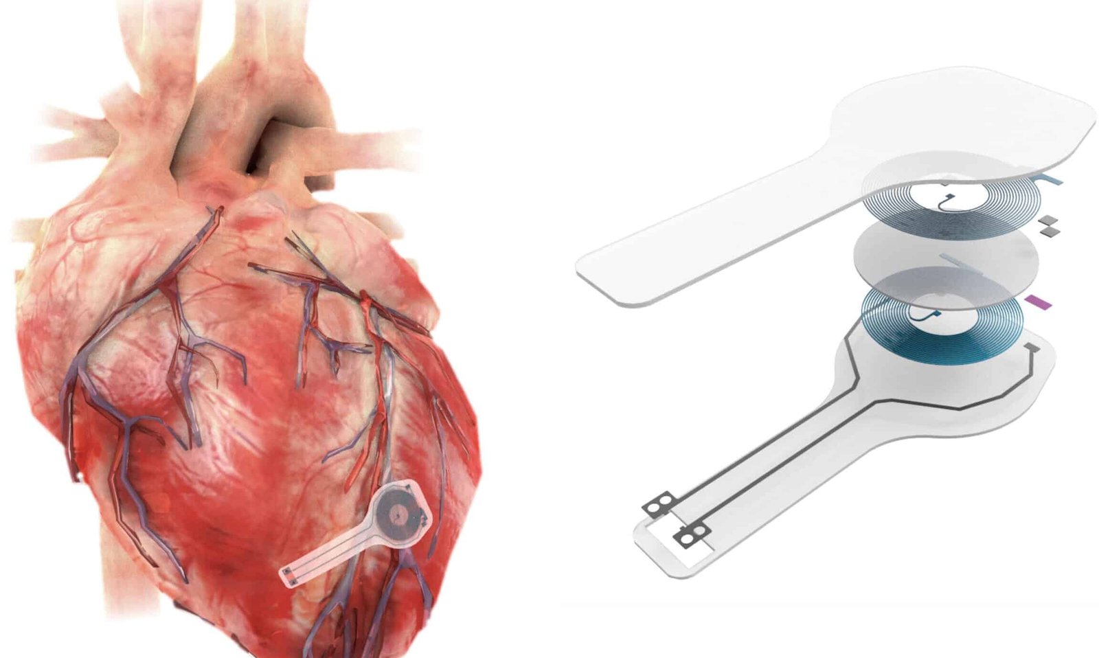 el-futuro-de-los-marcapasos-biologicos-sin-baterias