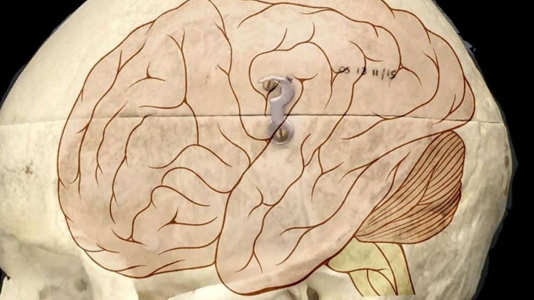 el-reto-de-la-entrega-de-genes-en-el-cerebro-humano