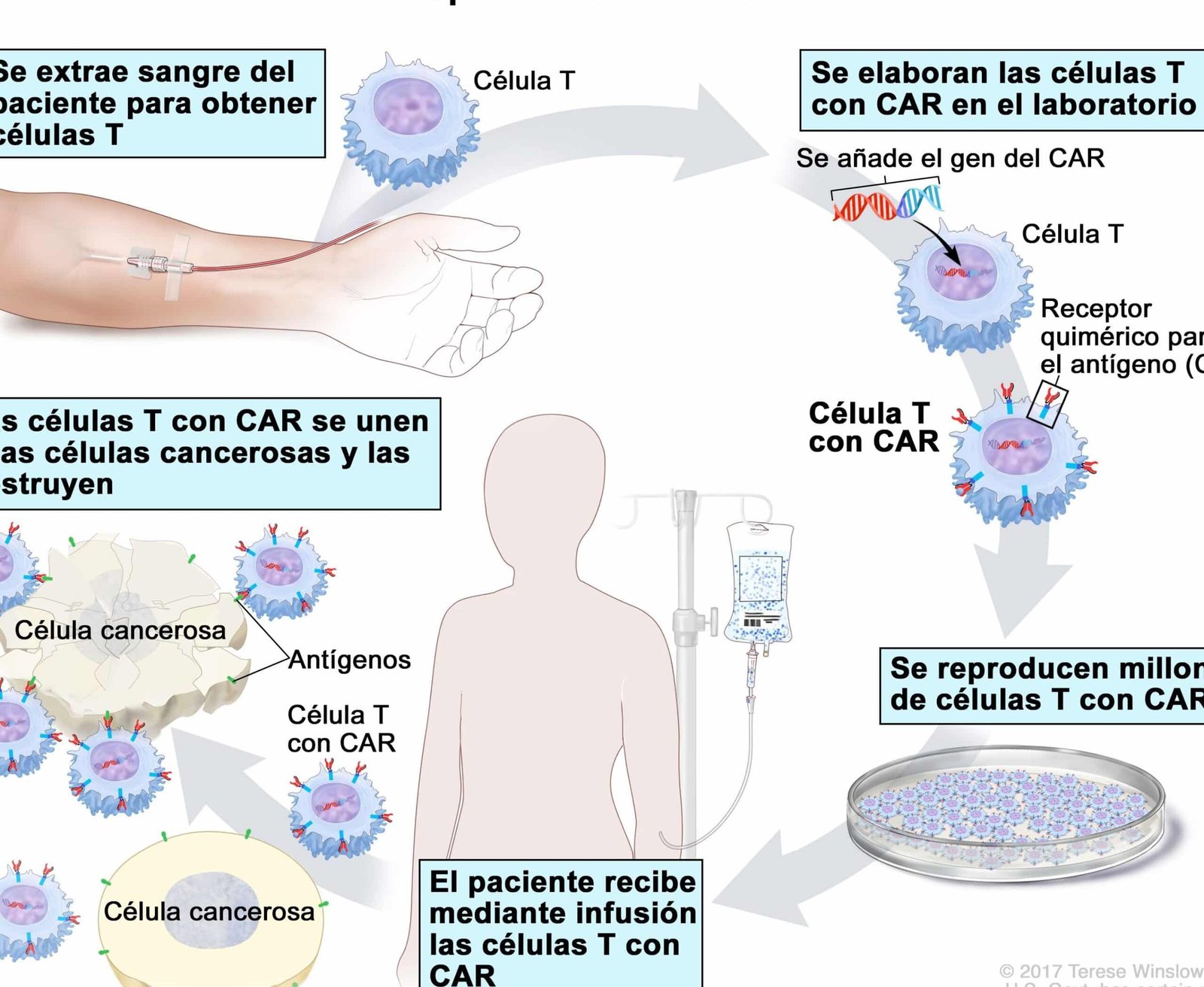 el-tratamiento-de-la-leucemia-con-celulas-car-t-de-nueva-generacion