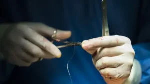 el-uso-de-seda-de-arana-en-aplicaciones-biomedicas