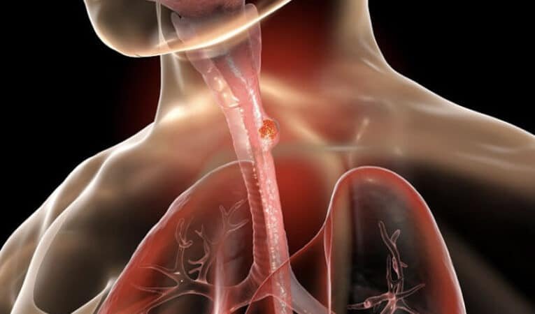 esofagos-bioingenierizados-avances-y-desafios