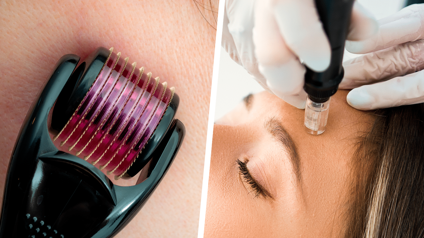 microagujas-bioinspiradas-para-inyecciones-sin-dolor