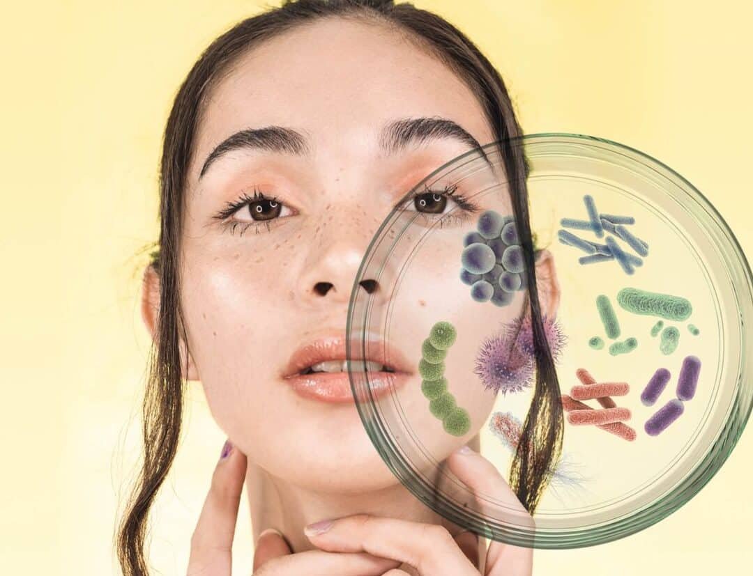 microbioma-de-la-piel-y-desarrollo-de-terapias-dermatologicas