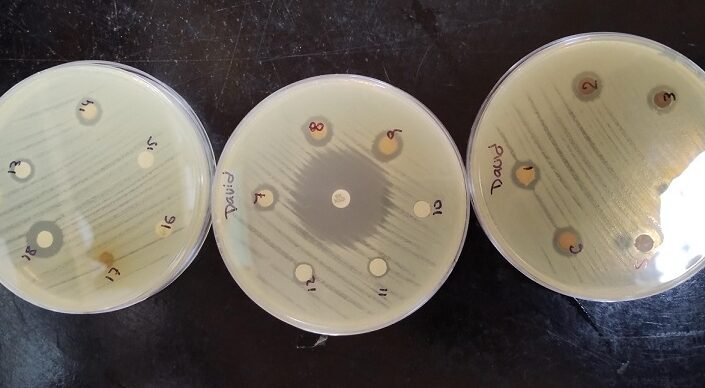 nanoparticulas-de-plata-propiedades-y-riesgos-en-medicina