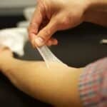 piel-artificial-bioingenierizada-para-tratar-quemaduras-graves