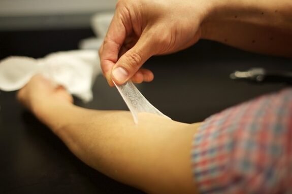 piel-artificial-bioingenierizada-para-tratar-quemaduras-graves