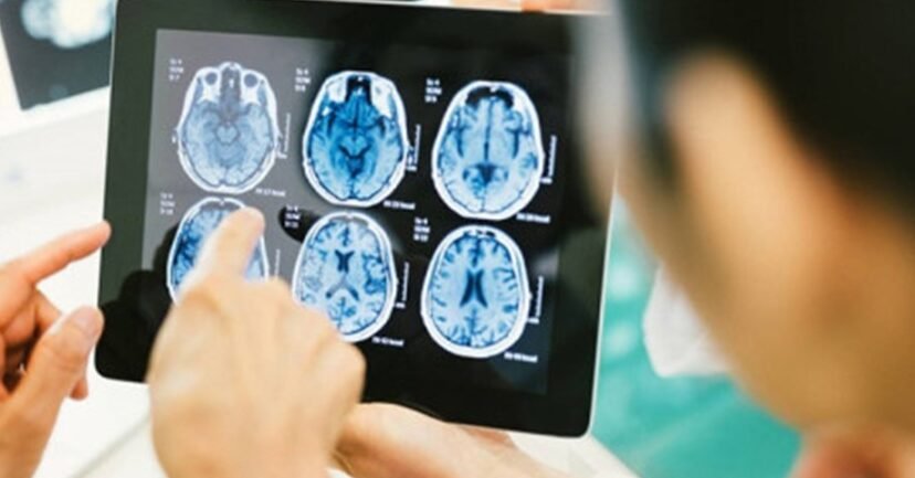 avances-en-la-terapia-celular-para-el-parkinson