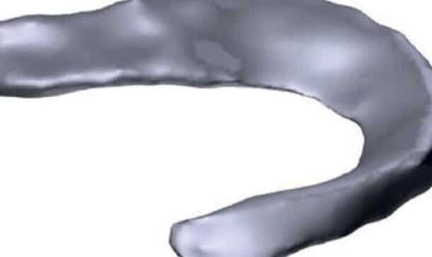 bioimpresion-de-meniscos-para-lesiones-de-rodilla