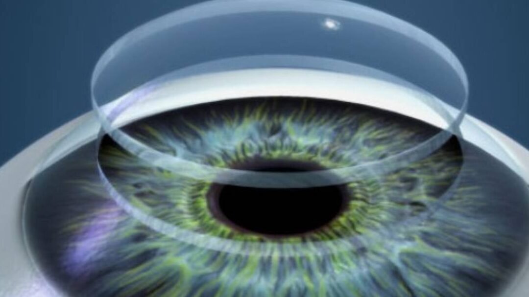 bioingenieria-de-tejido-corneal-para-trasplantes