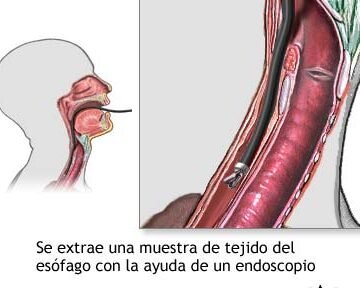 bioingenieria-de-tejido-esofagico