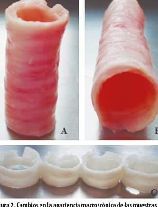 bioingenieria-de-tejido-traqueal