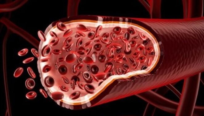 bioingenieria-de-vasos-sanguineos-humanos-para-dialisis