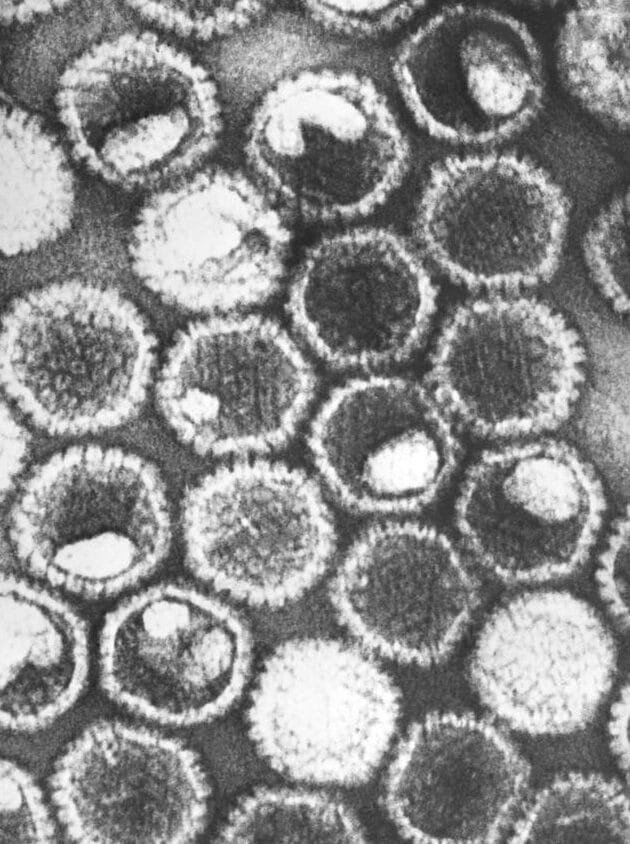 como-la-edicion-genica-podria-eliminar-el-herpes-virus
