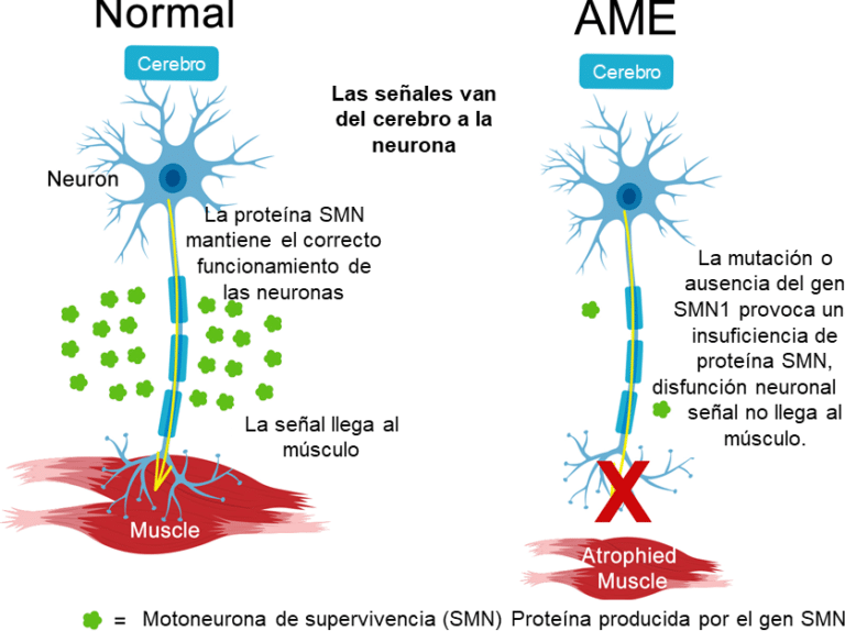 como-la-terapia-genica-aborda-la-atrofia-muscular-espinal