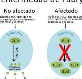 como-la-terapia-genica-aborda-la-enfermedad-de-fabry