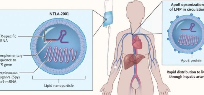 como-la-terapia-genica-in-vivo-trata-la-amiloidosis-hereditaria