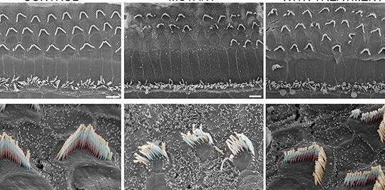 como-la-terapia-genica-restaura-la-audicion-en-ratones
