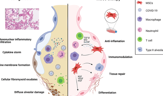 como-las-celulas-madre-mesenquimales-reducen-la-inflamacion-covid-19