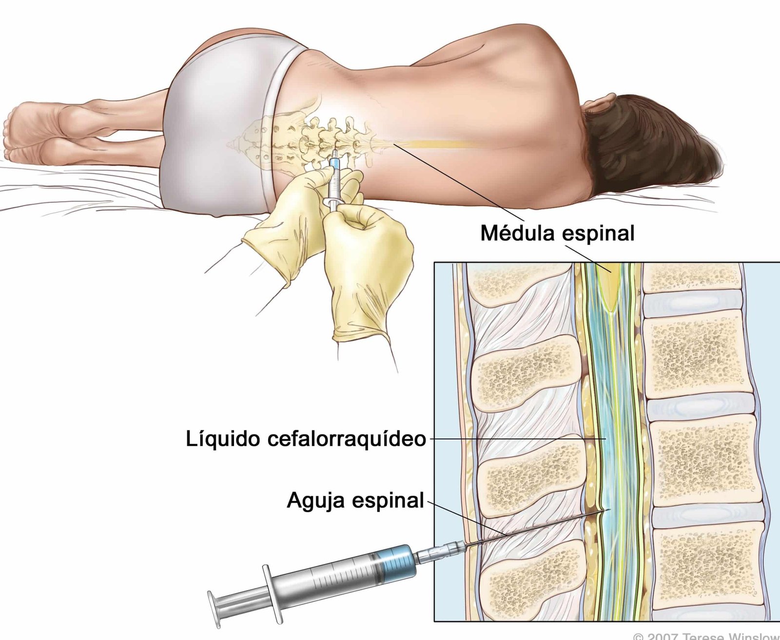como-las-terapias-avanzadas-tratan-la-leucemia-linfoblastica-aguda