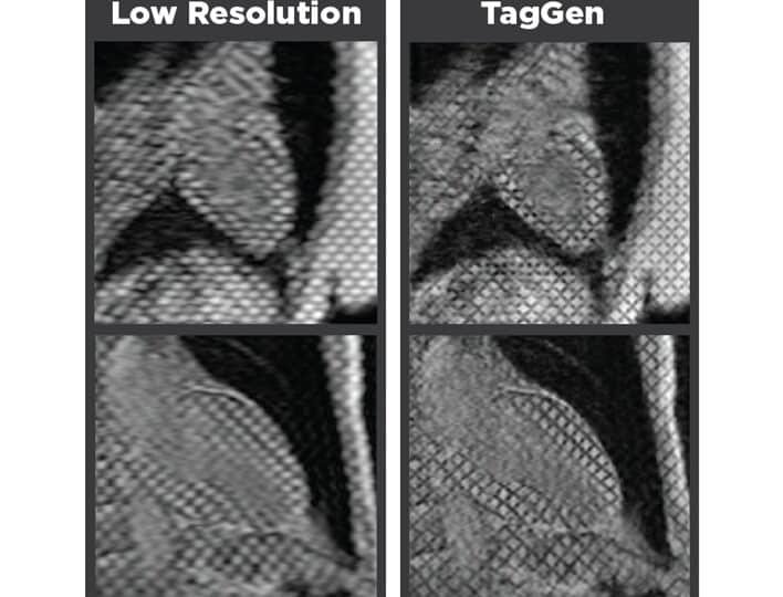 como-los-nanodiamantes-mejoran-la-resonancia-magnetica