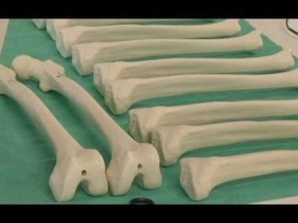 como-se-crean-huesos-sinteticos-que-el-cuerpo-absorbe-y-reemplaza