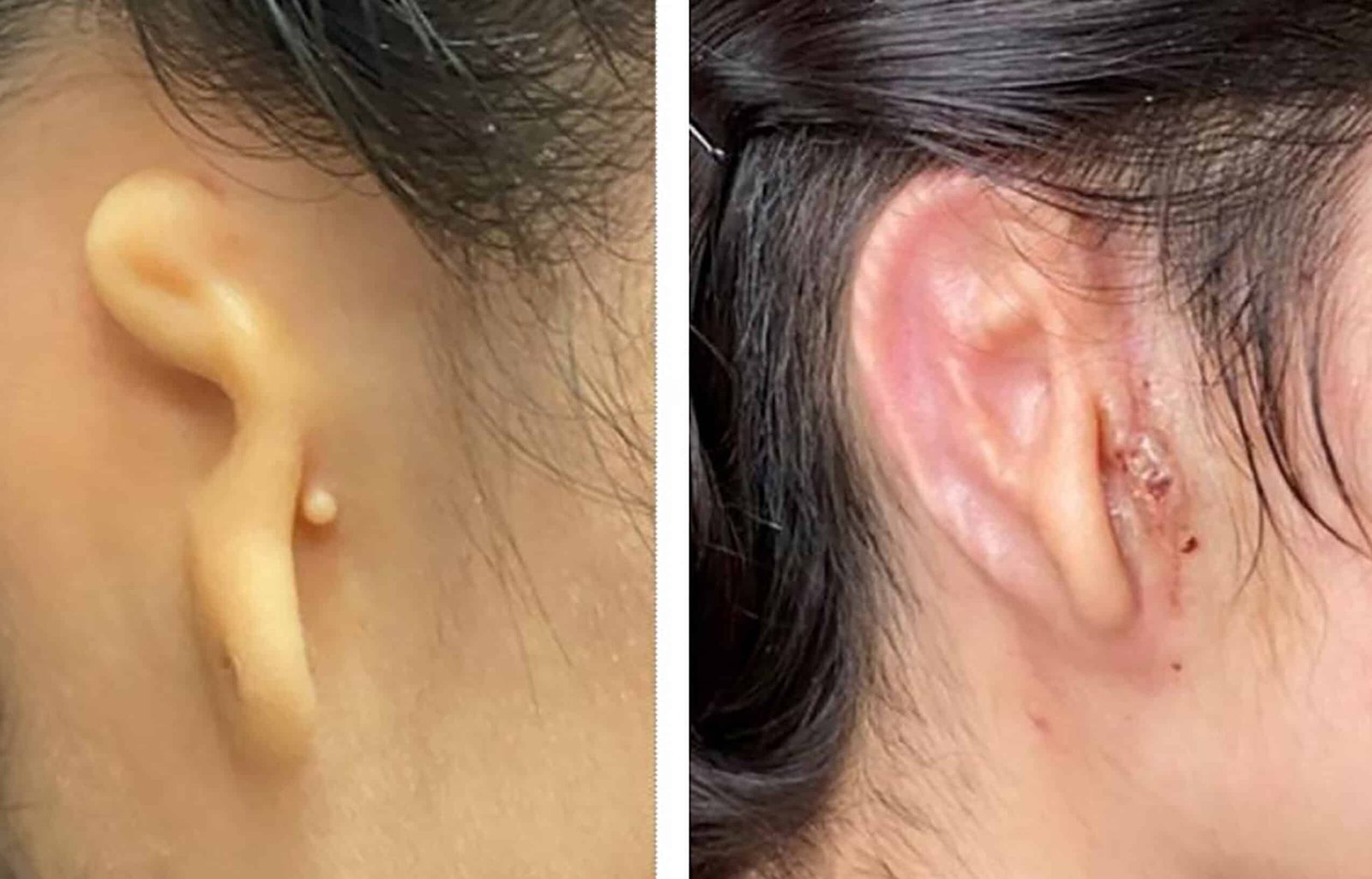 como-se-crean-oidos-artificiales-mediante-impresion-3d