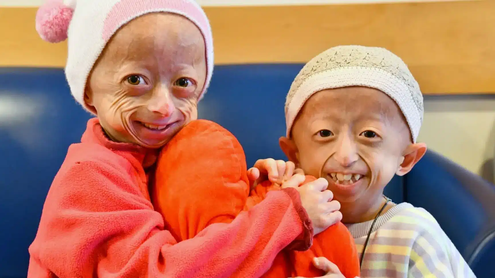 edicion-de-bases-para-curar-la-progeria-envejecimiento-prematuro