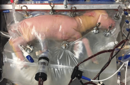 el-desarrollo-de-un-utero-artificial-para-la-gestacion-exogena
