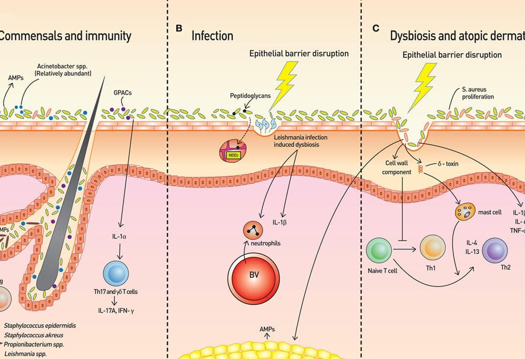 el-microbioma-de-la-piel-y-su-relacion-con-el-sistema-inmune