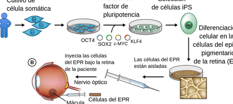 el-uso-de-celulas-ips-para-tratar-la-degeneracion-macular