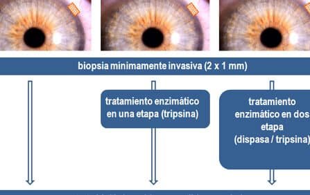 el-uso-de-celulas-madre-limbares-para-quemaduras-oculares