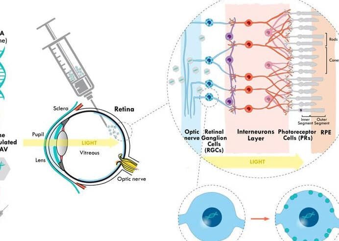 el-uso-de-crispr-para-corregir-la-ceguera-de-leber