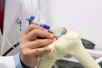 el-uso-de-hidrogeles-inyectables-para-regenerar-cartilago