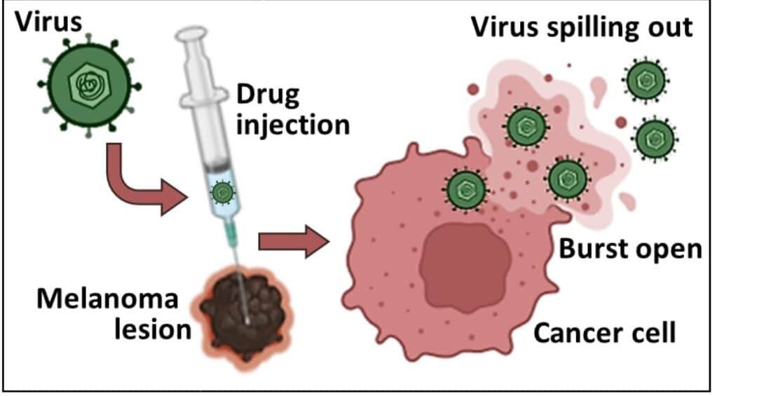 el-uso-de-virus-oncoliticos-para-atacar-el-melanoma