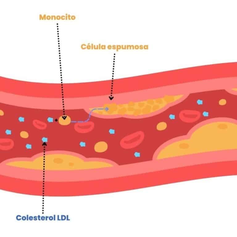 farmacogenomica-en-el-tratamiento-de-la-hipercolesterolemia-familiar