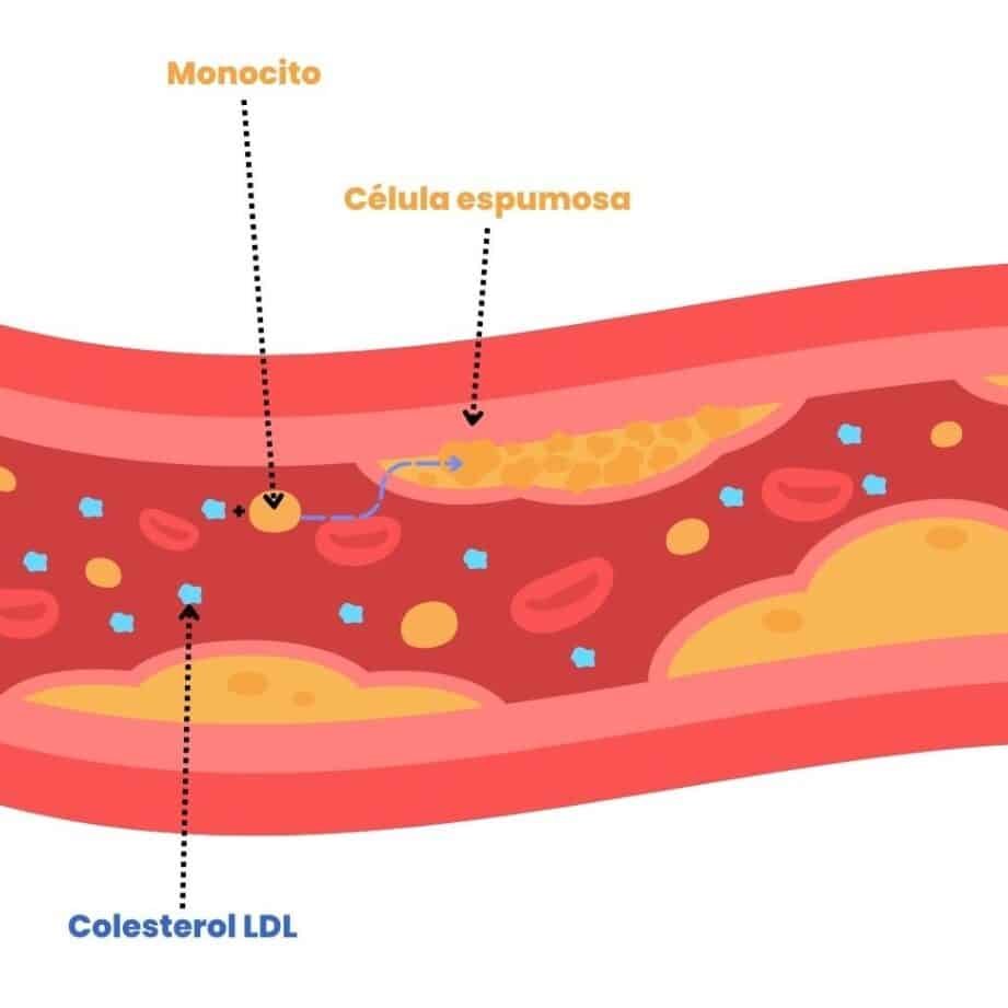 farmacogenomica-en-el-tratamiento-de-la-hipercolesterolemia-familiar