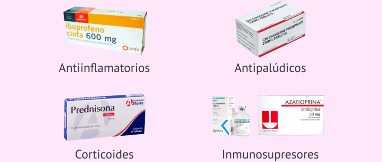 farmacogenomica-en-el-tratamiento-del-lupus-eritematoso
