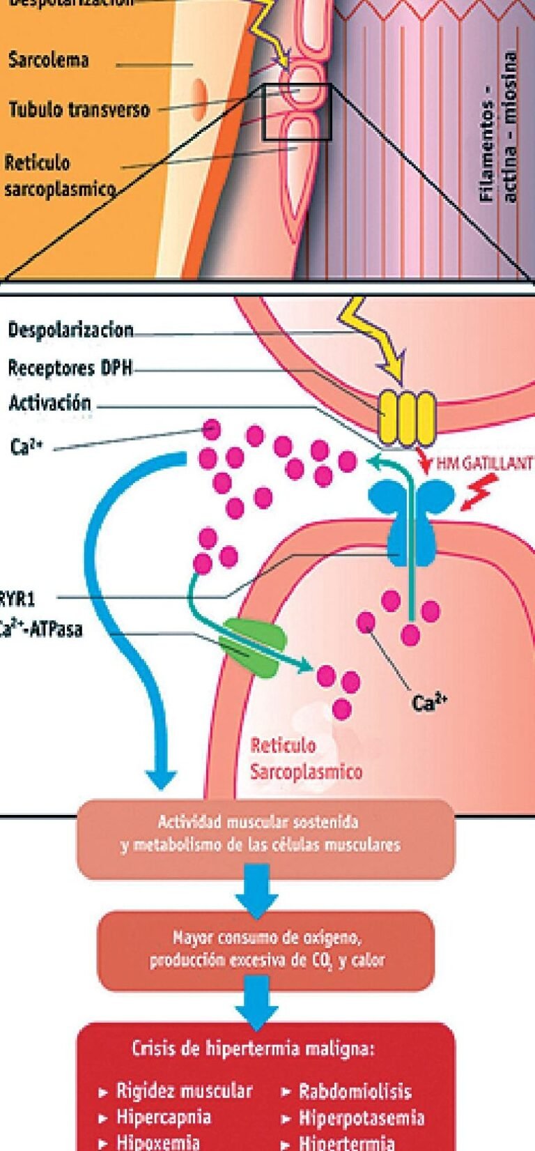 genes-que-afectan-la-eliminacion-de-la-anestesia-del-cuerpo