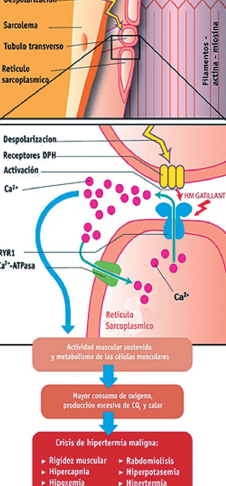 genes-que-afectan-la-eliminacion-de-la-anestesia-del-cuerpo