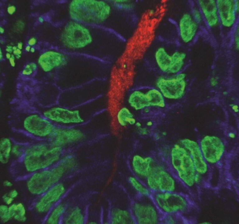 la-creacion-de-mini-estomagos-para-estudiar-bacterias-gastricas
