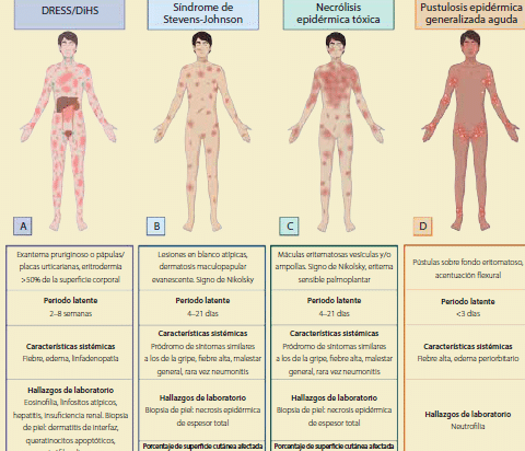 la-relacion-entre-genetica-y-efectos-adversos-cutaneos-graves-sjs-ten