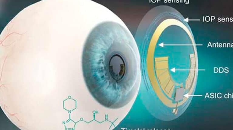 lentes-de-contacto-inteligentes-para-medir-la-presion-intraocular