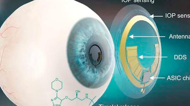 lentes-de-contacto-inteligentes-para-medir-la-presion-intraocular