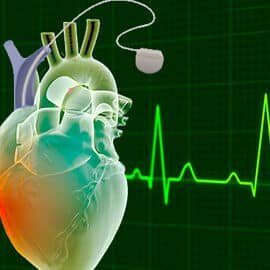 marcapasos-biologicos-creados-a-partir-de-celulas-madre