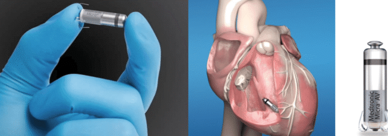 marcapasos-biologicos-sin-baterias-ni-cables